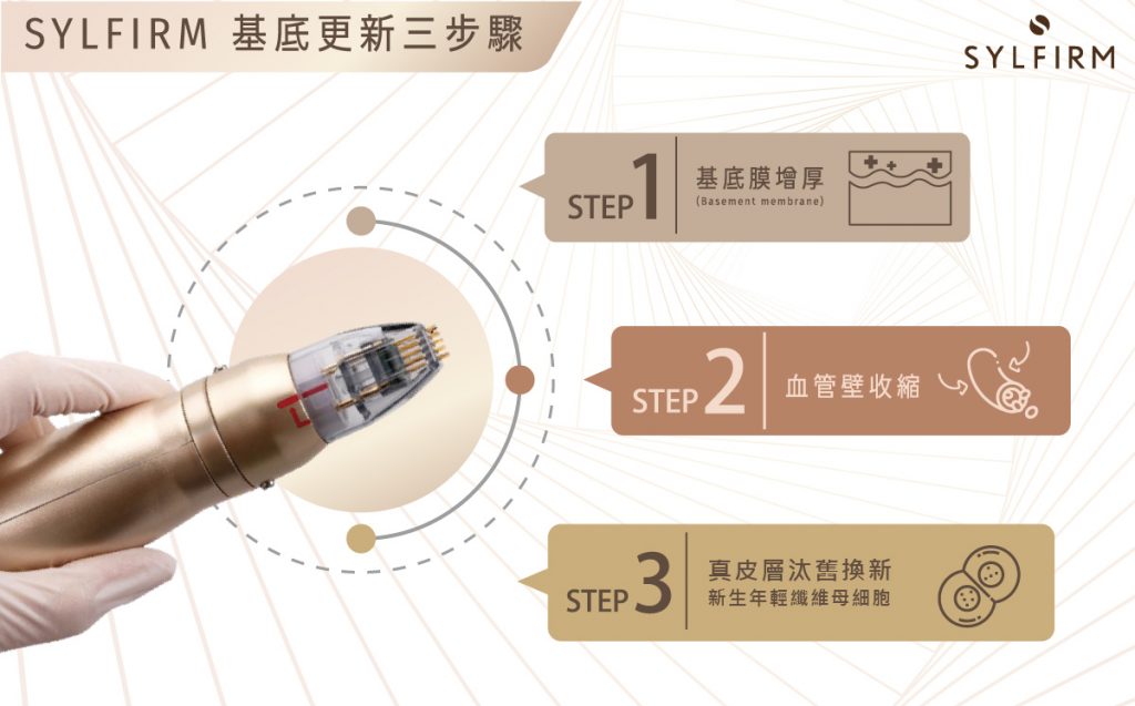Sylfirm矽谷電波不只能針對肝斑的根本因素給予治療，包含修復和強健基底膜、消除血管增生、加速色素代謝