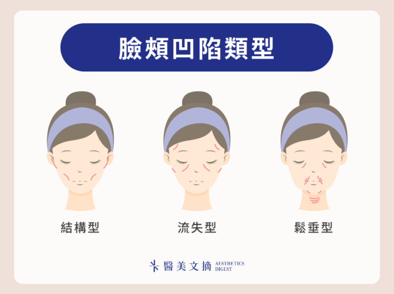 臉頰凹陷怎麼救?原因是什麼?臉部運動與3種醫美療程全解析 - 醫美文摘