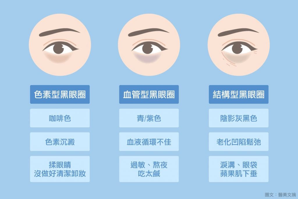 黑眼圈的類型