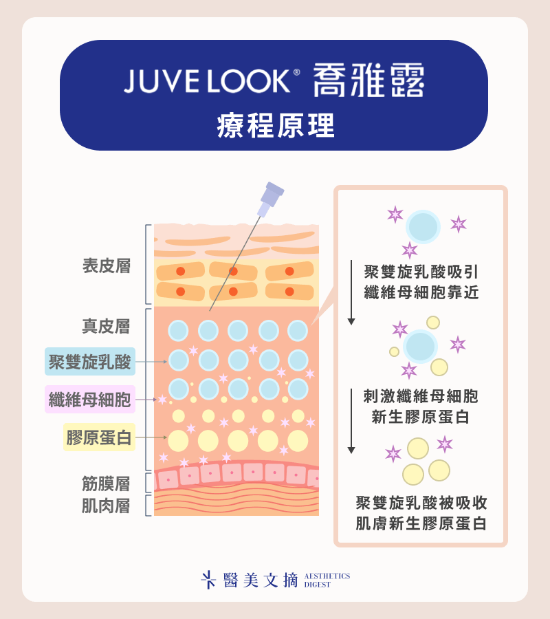 juvelook膠原蛋白增生劑療程原理