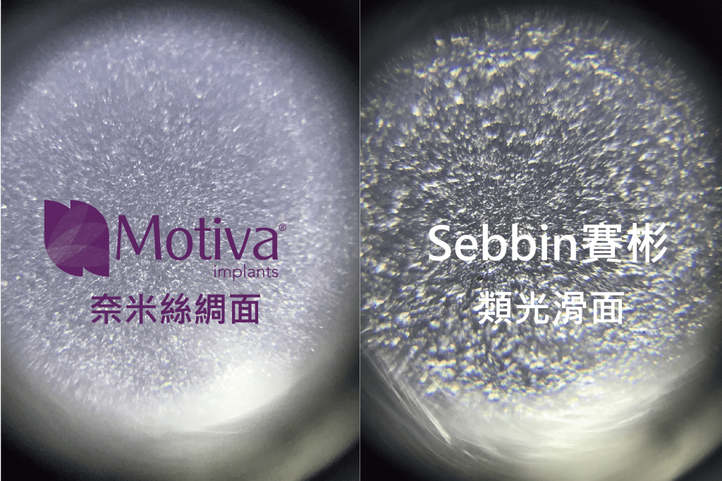 Motiva_VS_Sebbin