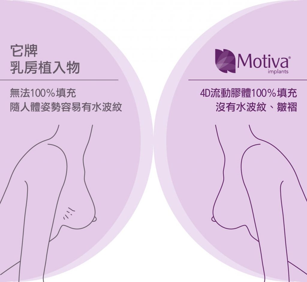 Motiva_implants
