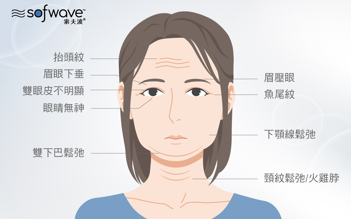 Sofwave索夫波可改善的臉部鬆弛及紋路狀況