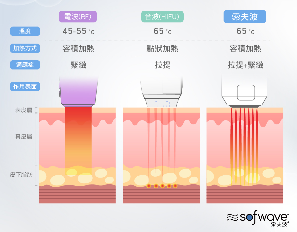 Sofwave索夫波和音波拉提及電波拉皮的差別