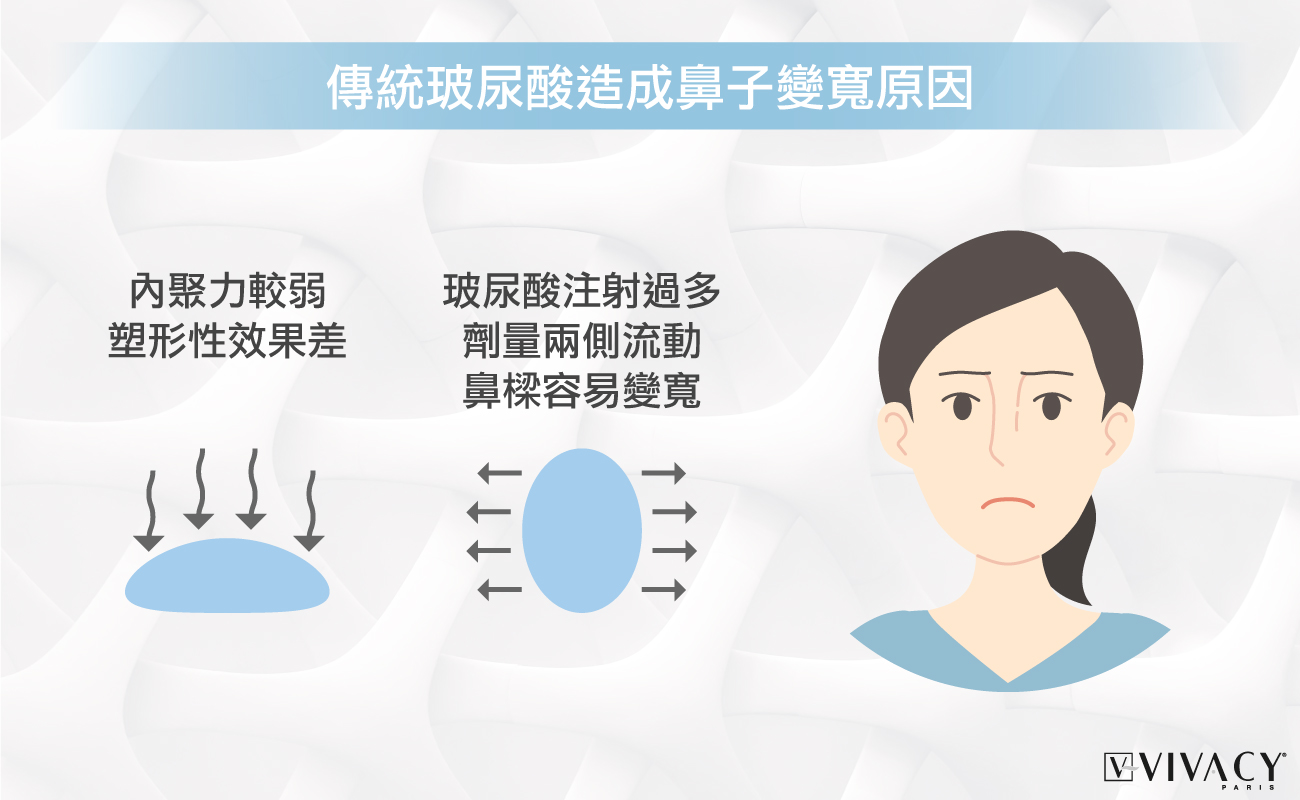 傳統玻尿酸造成鼻子變寬的原因