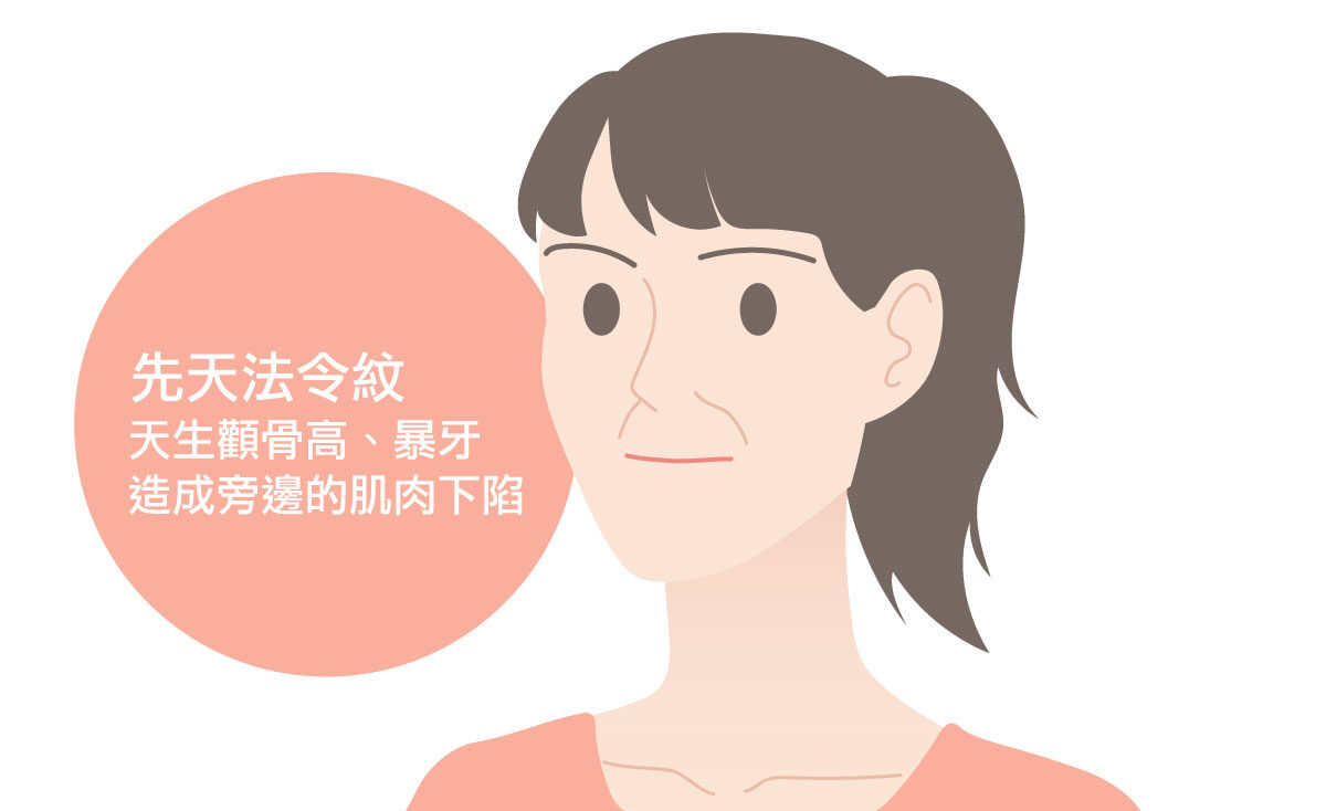 先天的法令紋為什麼原因