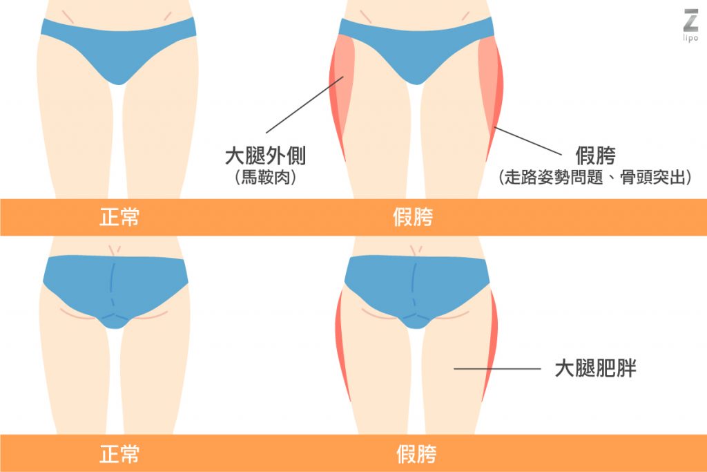 假跨寬