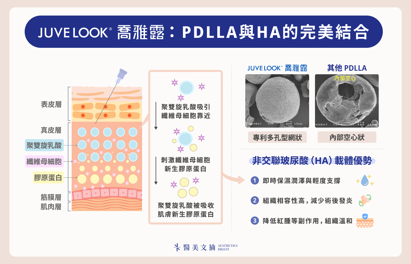 喬雅露是什麼：PDLLA＋非交聯玻尿酸成分組成