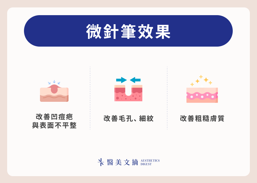 微針筆效果