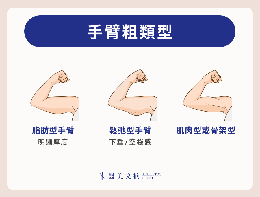 手臂粗類型