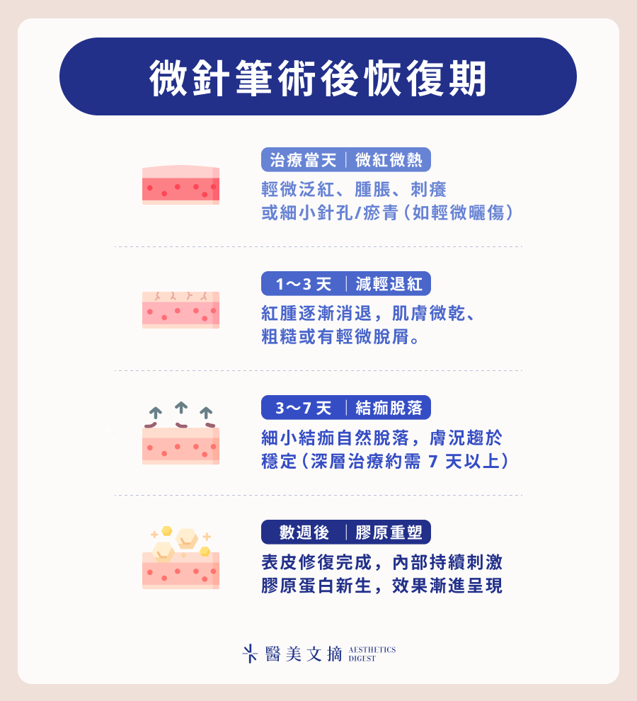 微針筆術後恢復期