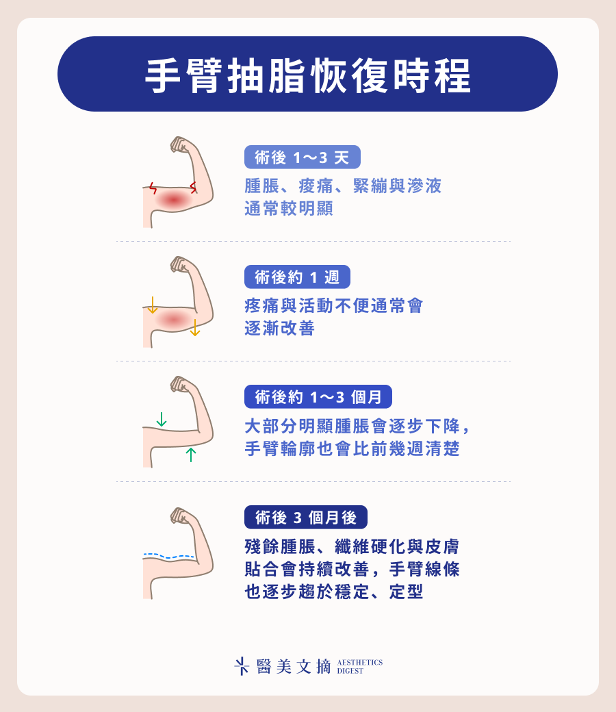 手臂抽脂恢復時程