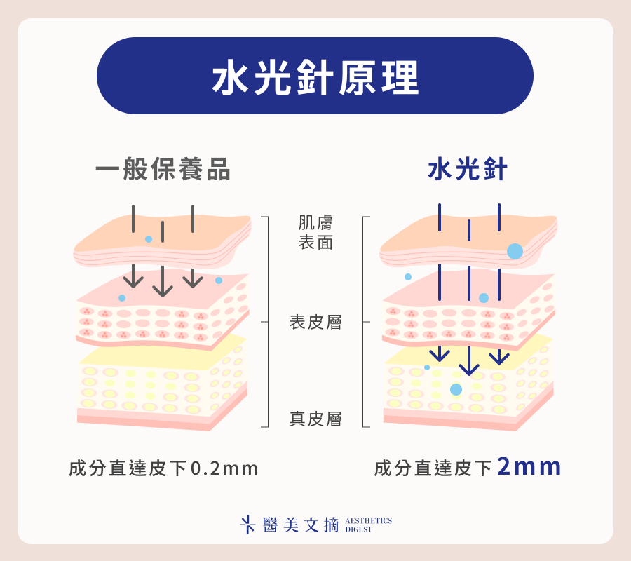 水光針原理