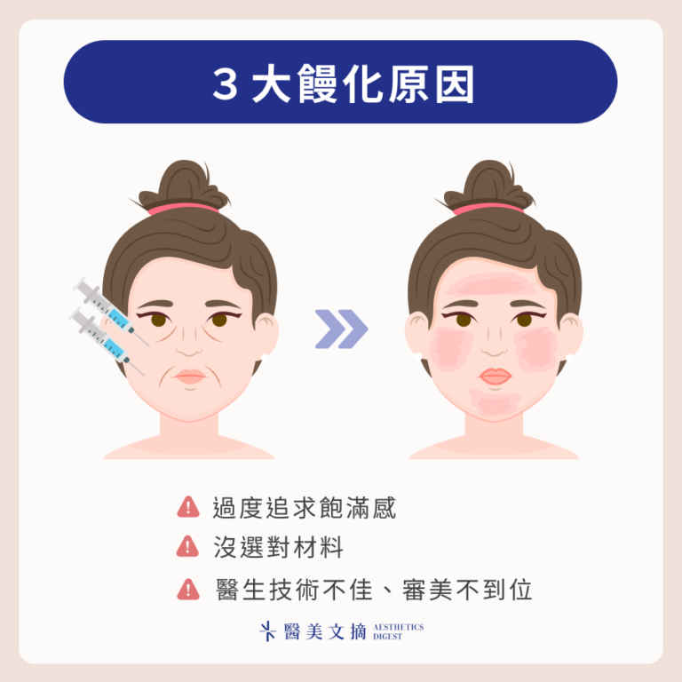 饅化長怎樣?有機會修復嗎?做醫美前記住這4個避免饅化臉的重點 - 醫美文摘