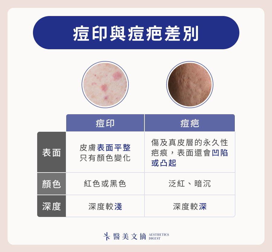 痘斑、痘疤差在哪?