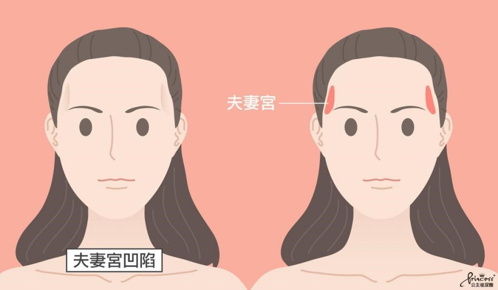 什麼是夫妻宮凹陷
