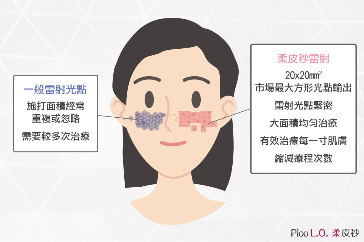 Pico L.O.柔皮秒雷射和一般雷射差別