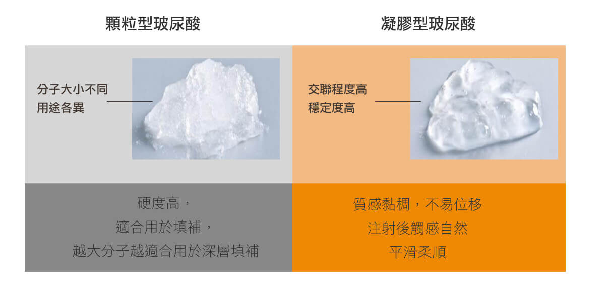 顆粒型玻尿酸和凝膠型玻尿酸差異