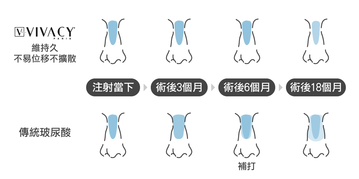 Vivacy玻尿酸持久度