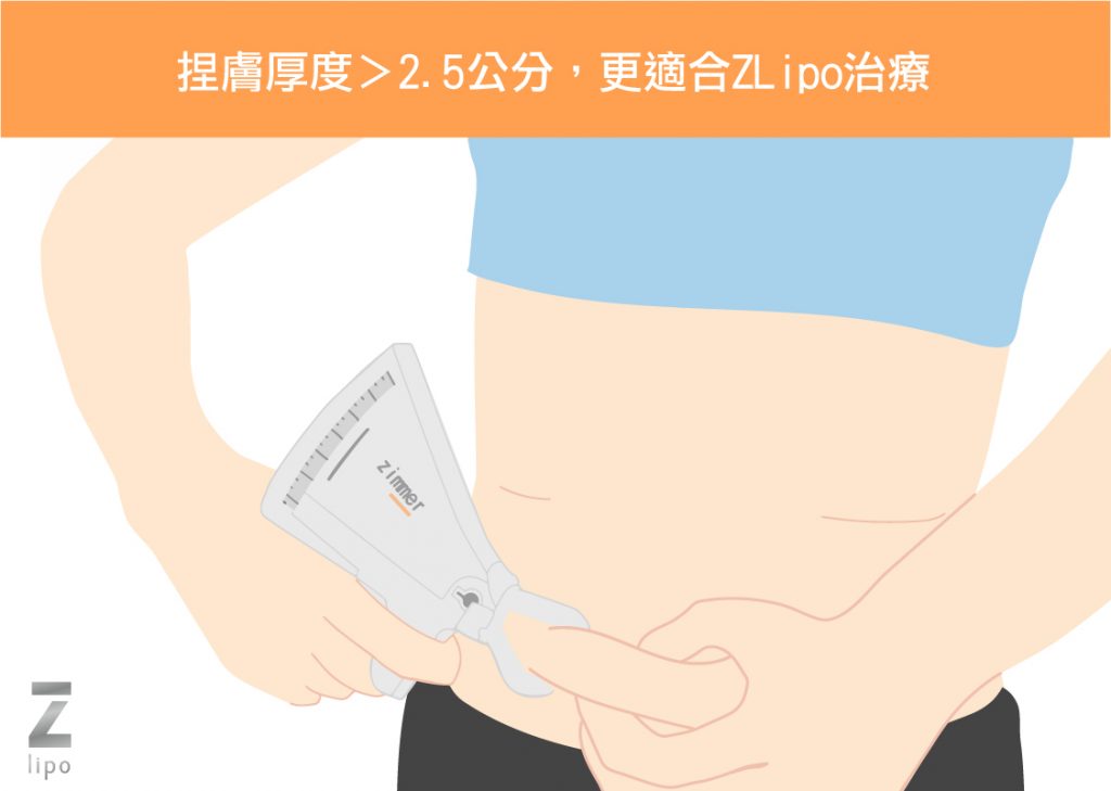 小腹肥胖捏膚測試